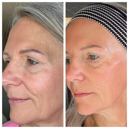 VOLURÉE PDRN + Copper Peptide Serum