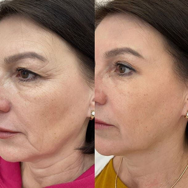 VOLURÉE PDRN + Copper Peptide Serum